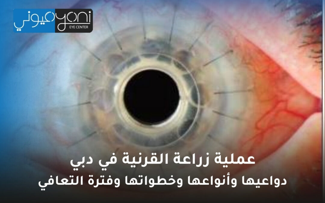 عملية زراعة القرنية في دبي: دواعيها وأنواعها وخطواتها وفترة التعافي