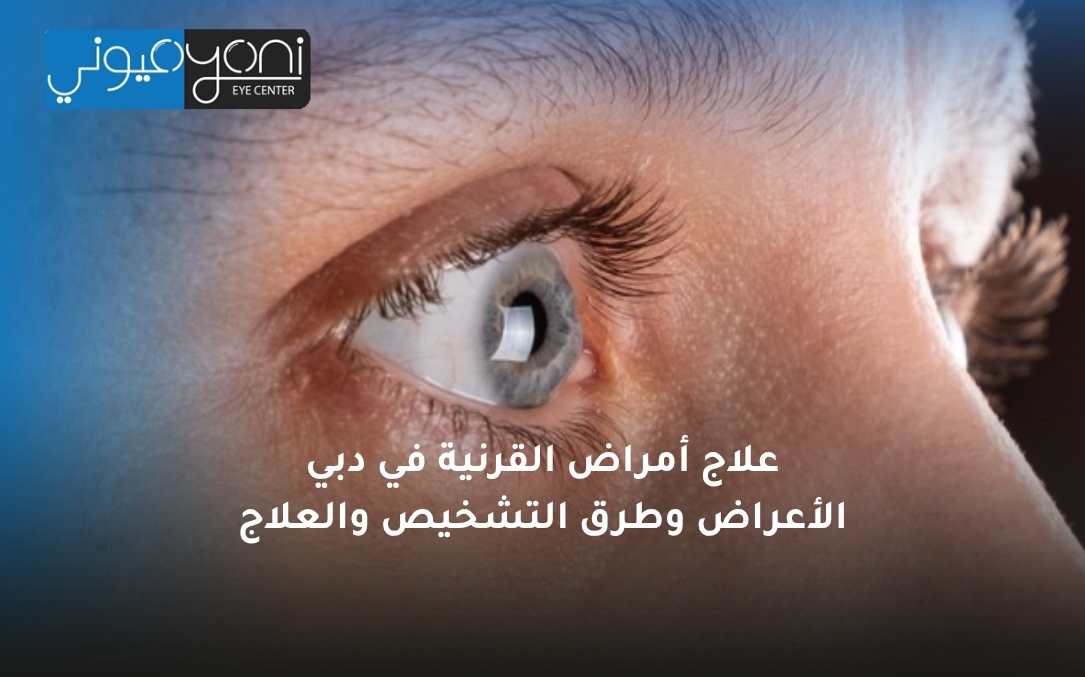 علاج أمراض القرنية في دبي